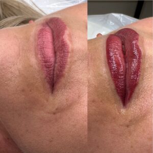 Permanet makeup læber før og efter behandling hos Miss Diva E.